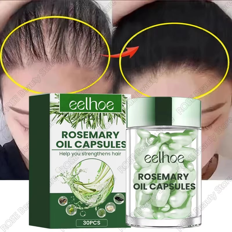 Hair Growth Essential Oil Rosemary Hair Serum Capsule Oil anti Hair Loss Baldness Repair Damaged Scalp Treatment for Women Men