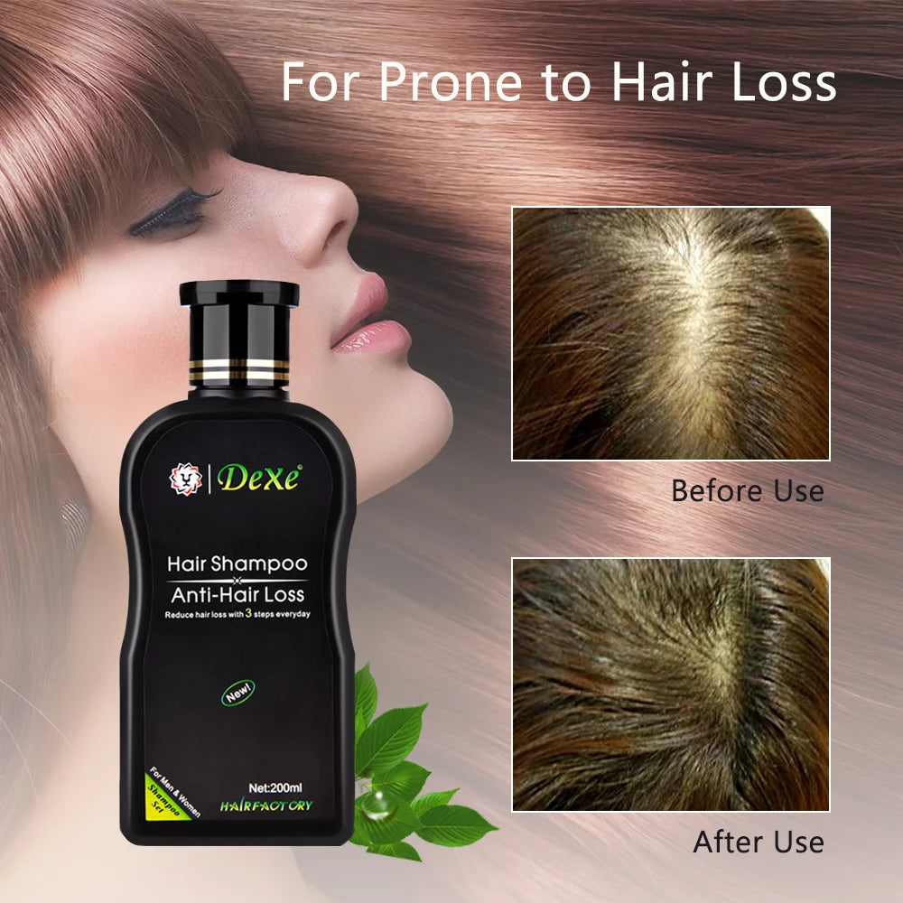 Hair Growth Shampoo, Anti-Hair Loss Hair Growth Shampoo, with Ginger Oil & Keratin for Hair Loss and Thinning Hair, Fights Hair Loss, for Men and Women, 200Ml, 1PC